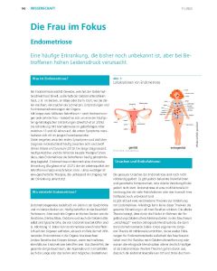 Download: Endometriose (Teil 1 + 2)