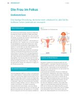 Download: Endometriose (Teil 1 + 2)