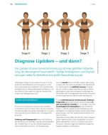 Download: Diagnose Lipödem – und dann?